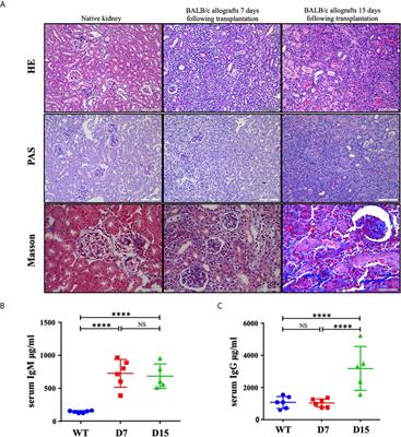 Single-Cell RNA Sequencing Reveals the Immunological Profiles of Renal Allograft Rejection in Mice